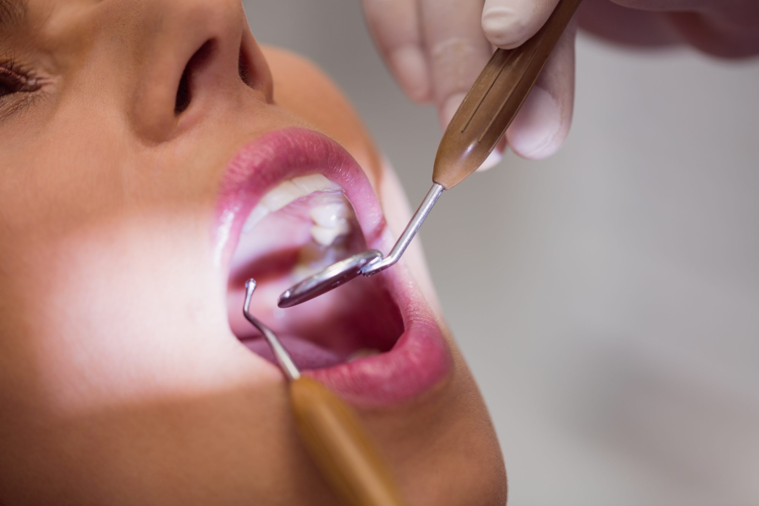 Understanding Oral Pathology: Early Detection and Treatment in Hattiesburg, MS, and Laurel, MS